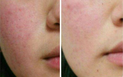 Soothing and Anti-Aging Care Liquid